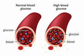 Ayurvedic Treatment For Diabetes